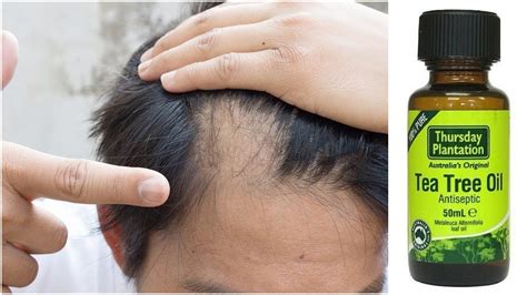 How To Use Tea Tree Oil For Hair Growth Hair Growth Oil Tea Tree Oil