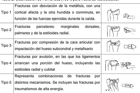 EvaluaciÓn Funcional De Fracturas Radiodistales En Adultos Tratados Con