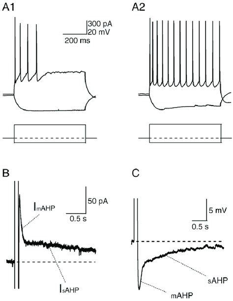 Electrophysiological Properties Of Layer V Pyramidal Neuron In The