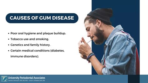 Gum Disease Demystified PPT