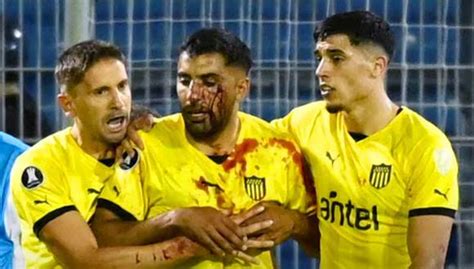 El descargo del jugador de Peñarol agredido en Rosario Una vergüenza