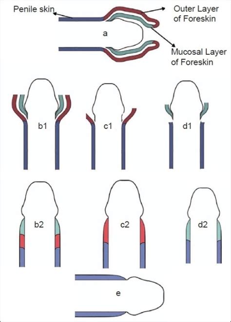 Diagram Circumcised Vs Uncircumcised Captain America Wallpap