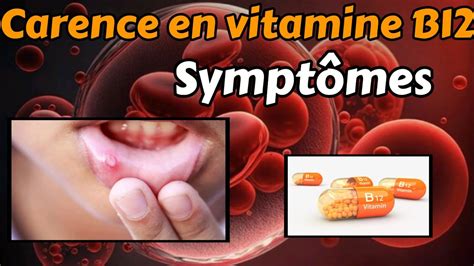 La Carence En Vitamine B Symptomes Diagnostic Traitement Youtube