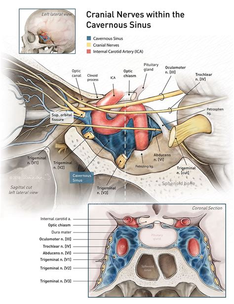 Cranial nerves within the cavernous sinus | AMI 2018 Meeting | Cranial ...