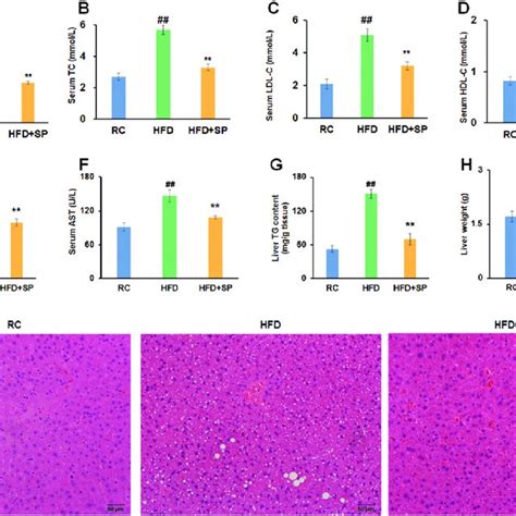 Effects Of Sp On The Serum And Liver Lipid Levels In Hfd Induced Obese