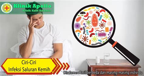 Cermati Ciri Ciri Infeksi Saluran Kemih Bagian Atas Dan Bawah