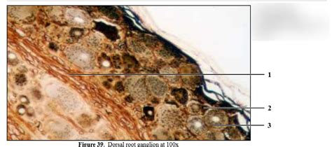 Dorsal Root Ganglion 100x, 400x Diagram | Quizlet