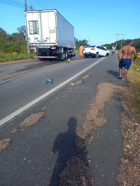 Mulher Fica Gravemente Ferida Em Acidente Entre Carro E Caminh O Em Pacajus