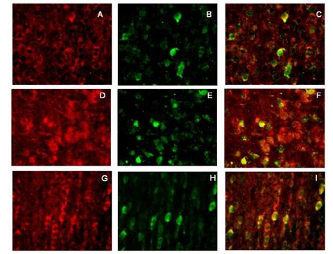 Double Immunofluorescence Staining Of P Brain Sections For