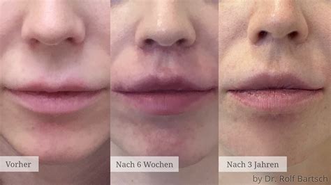 31603 TheAesthetics Dr Rolf Bartsch Dr Katrin Bartsch Plastische