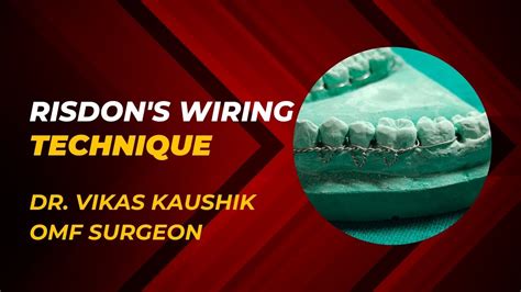 Risdon S Wiring Technique Viral Smile Trauma Fracture