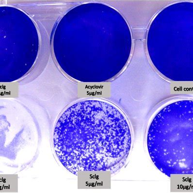 Plaques Assay Plate Explains The Cytopathic Inhibition Activity Of Scgl