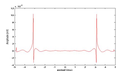 Figure 2 From Removal Of Embedded Artefacts In Ecg Signals By