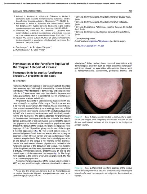 Pigmentation Of The Fungiform Papillae Of The Tongue A Report Of 2