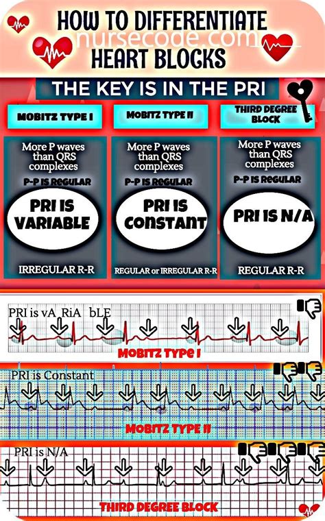 How To Differentiate Heart Blocks Inforgraphic Icu Nursing Critical Care