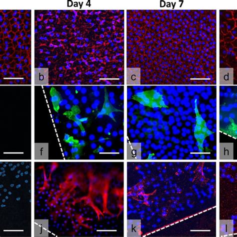 Endothelial Cell Density Of Quarterdmek Grafts During Storage In Download Scientific Diagram