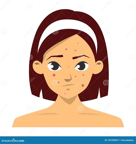 Beatiful Girl with Acne. Red Pimple on the Face Stock Illustration ...