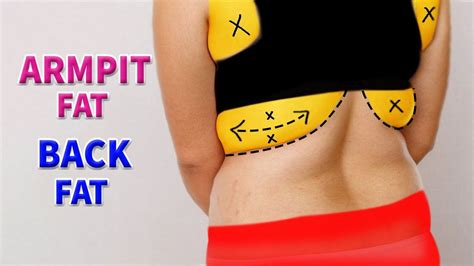 5 Simple Exercise To Burn Back Armpit Fat Artofit