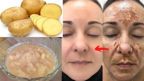 Masque à la pomme de terre pour une peau hydratée astuce beauté avec