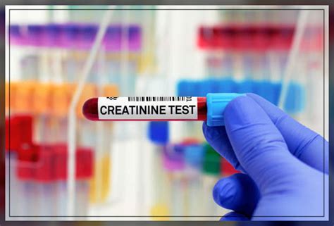 Creatinine Test: Purpose, Procedure, and Results - Engiomed