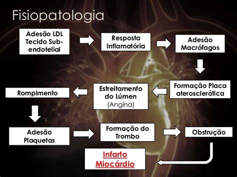 Infarto Agudo Do Miocardio Fisiopatologia Elia Ascer