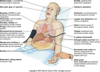 Chapter 21 Peripheral Vascular Lymphatic System Flashcards Quizlet