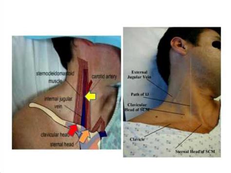 Jugular Vein Anatomy Anatomical Charts Posters