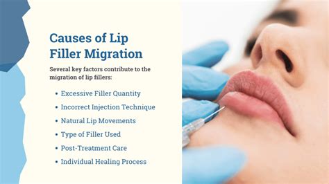 How To Tell If You Have Lip Filler Migration