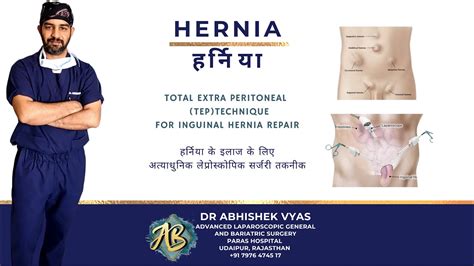 Bilateral Inguinal Hernia Youtube