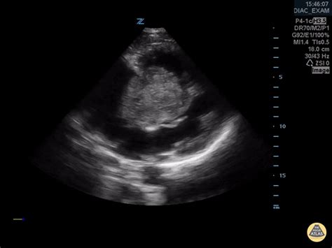 E-FAST – UCSD Ultrasound