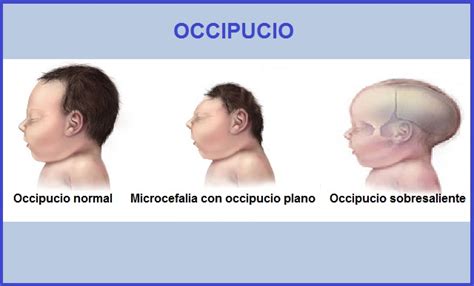 Occipital Características Funções Malformações