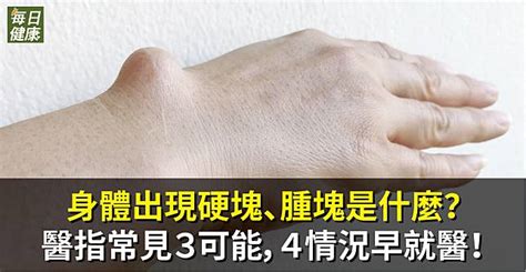 身體出現硬塊、腫塊是什麼？醫指常見3可能，4情況早就醫！ 每日健康 Line Today