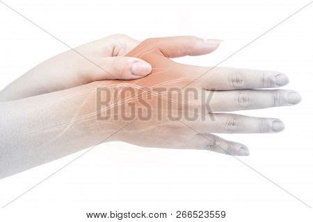 Hand Nerve Pain White Image & Photo (Free Trial) | Bigstock