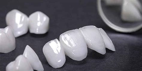 Tipos De Carillas Dentales Badia Cl Nica Dental