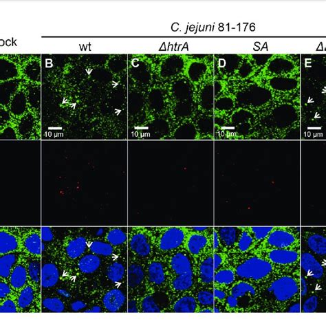 Infection Of Polarized Caco Epithelial Cell Monolayers By C Jejuni