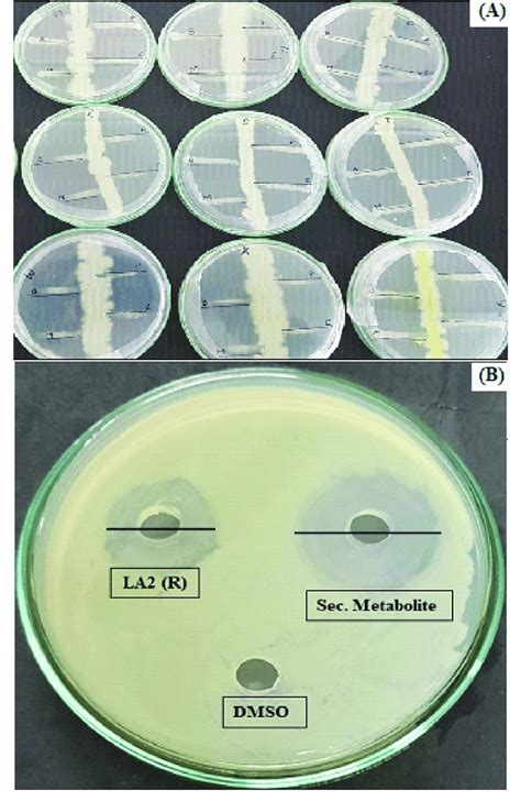 A Primary Screening Of Actinobacteria Using The Perpendicular Streak