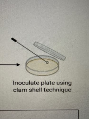 Aseptic Technique Streak Plate Method And Staining Quiz 1 Flashcards