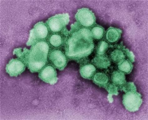 Swine Flu Virus Not So New Study Finds