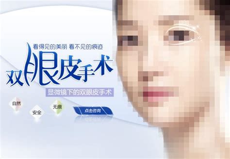 上海做了双眼皮，医生为什么建议要多睁眼？上海美莱整形医院