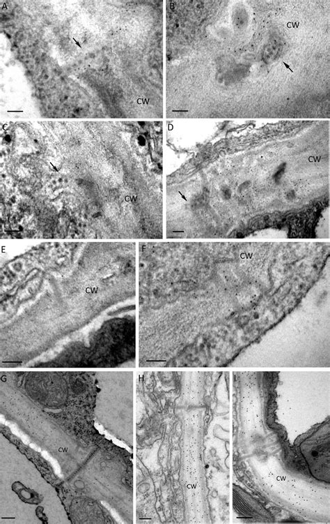 Immuno Gold Labeling Of The Cell Wall Components Callose And Cellulose