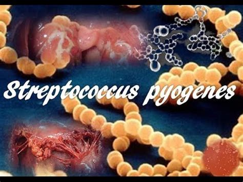 Streptococcus Pyogenes YouTube