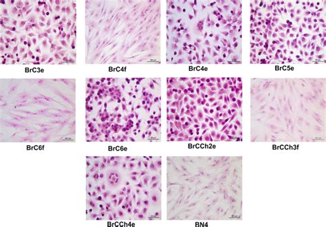 Breast Cancer Cells Vs Normal Cells Under Microscope Cancer Symptom