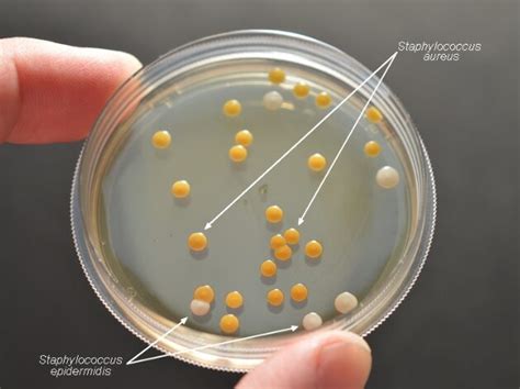 Tryptic Soy Agar Scheda Del Terreno Di Coltura Per Microbiologia