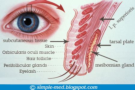 The Patient's Guide to Dry Eye Syndrome: Meibomian Gland Dysfunction ...