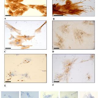 Light Micrographs Of Bcpc Immunostained For A Panck X B Ck