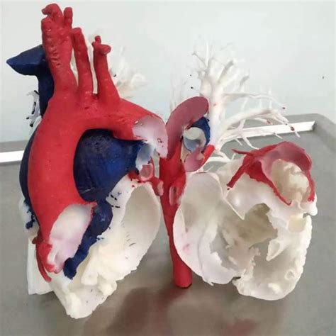 3D Printed Heart Model5 VoxelMatters The Heart Of Additive