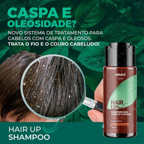 Shampoo Contra Caspa E Fungos No Couro Cabeludo Hair Up Parcelamento