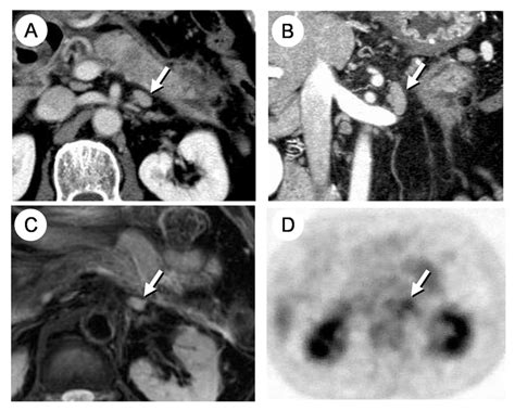 Preoperative Imaging Studies Download Scientific Diagram