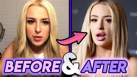 Tana Mongeau Before And After Plastic Surgery Transformation Youtube