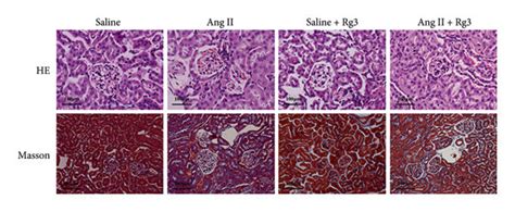 Representative He And Masson Staining Histology Photomicrographs Of The Download Scientific